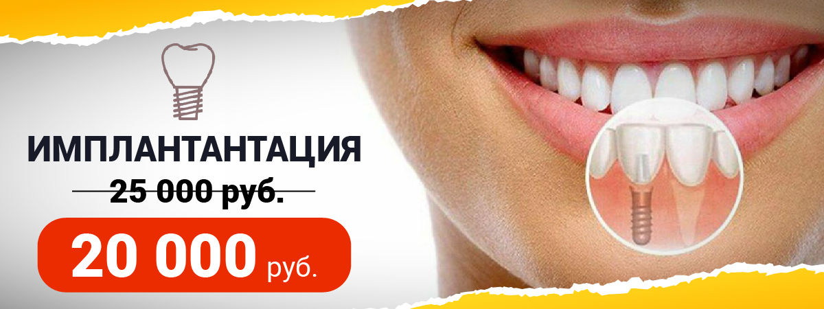 Бесплатная консультация в стоматологии в Сочи