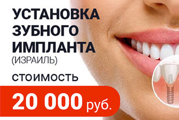 Установка зубного импланта (Израиль) 20 000 рублей